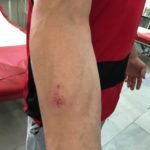 Ясно се виждат следите от сблъсъка с разследващия.